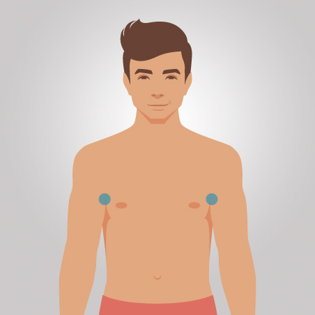 Depilação a Laser Axilas Masculino (Pacote Completo) Espaçolaser