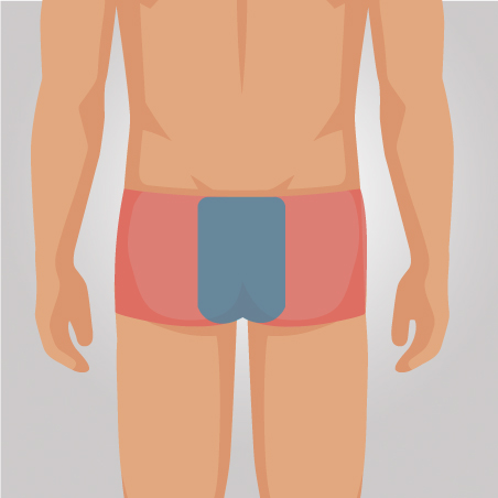 Depilação a Laser Glúteos Médios Masculino Pacote Completo