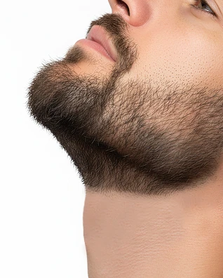 Depilação à Laser na Faixa de Barba